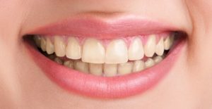 healthyteethandsmile-over